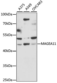 MAGEA11 Polyclonal Antibody (E-AB-91101)