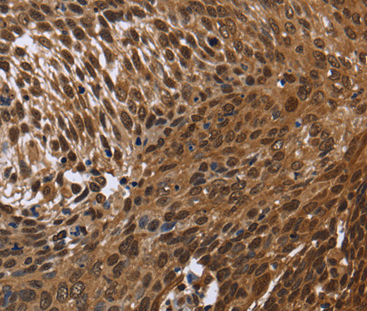 DCP1A Polyclonal Antibody (E-AB-11140)