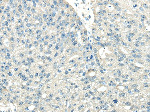VPS36 Polyclonal Antibody (E-AB-17561)