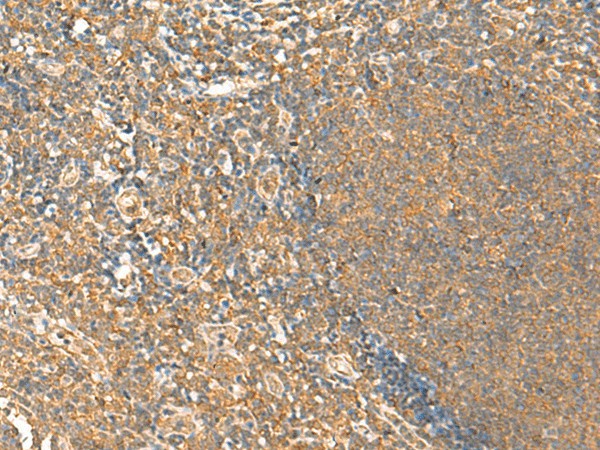 HTT Polyclonal Antibody (E-AB-18100)