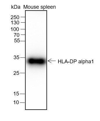 Recombinant HLA-DPA1 Monoclonal Antibody (AN301550L)