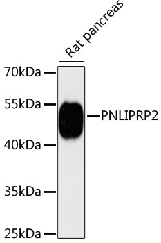 PNLIPRP2 Polyclonal Antibody (E-AB-65978)