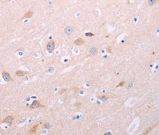 ADCY5 Polyclonal Antibody (E-AB-16137)