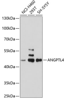 ANGPTL4 Polyclonal Antibody (E-AB-60554)