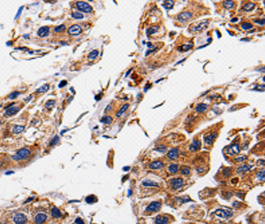 RAB41 Polyclonal Antibody (E-AB-15470)