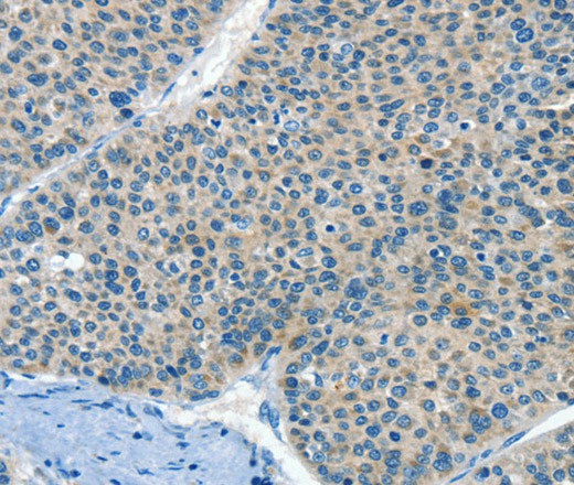 HID1 Polyclonal Antibody (E-AB-16355)