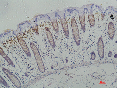 Galectin 3 Monoclonal Antibody (E-AB-22191)
