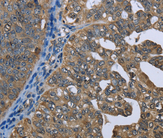 GPAM Polyclonal Antibody (E-AB-11282)
