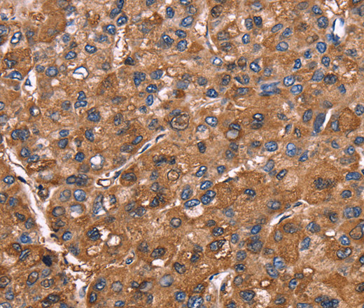 ELP2 Polyclonal Antibody (E-AB-14722)