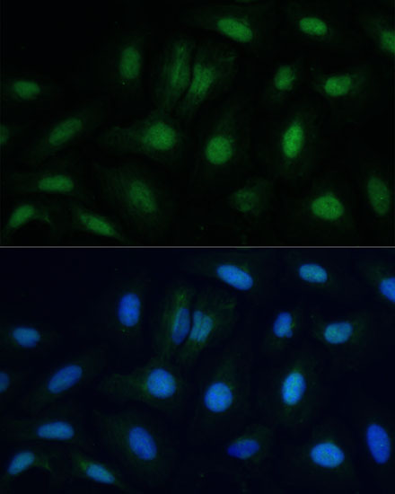 ETS2 Polyclonal Antibody (E-AB-62076)