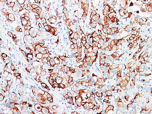 GCDFP-15 Monoclonal Antibody (ELAB6661-M)