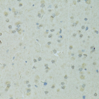TRIM28 Polyclonal Antibody (E-AB-63719)