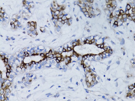 BRCA1 Polyclonal Antibody (E-AB-60016)