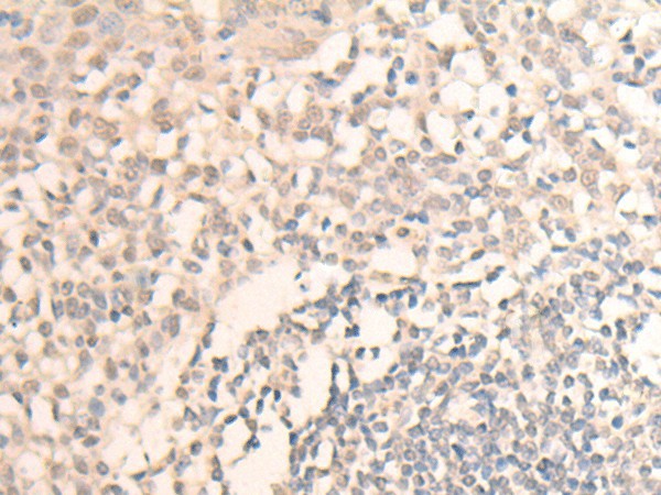 MLLT6 Polyclonal Antibody (E-AB-18727)