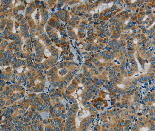 PPARGC1B Polyclonal Antibody (E-AB-16705)