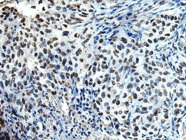 DDX39A Polyclonal Antibody (E-AB-18651)