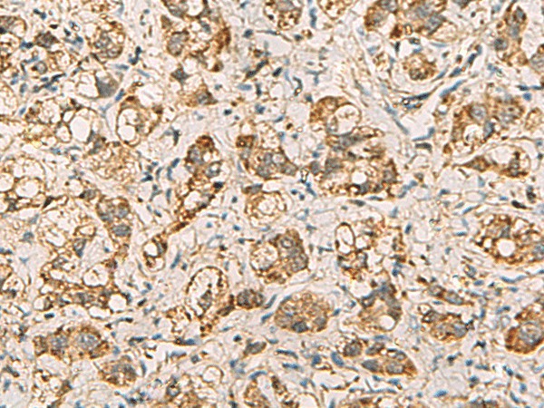 VTA1 Polyclonal Antibody (E-AB-19219)