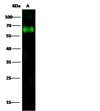 CD73/NT5E Monoclonal Antibody (AN200194P)