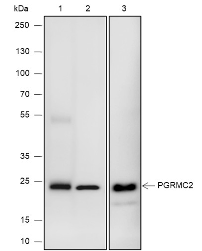 Recombinant PGRMC2 Monoclonal Antibody (AN301926L)