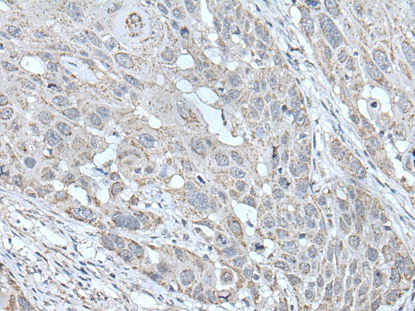 SCNN1G Polyclonal Antibody (E-AB-18261)