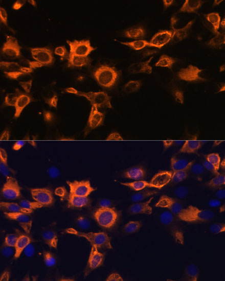 CSF2 Polyclonal Antibody (E-AB-65534)