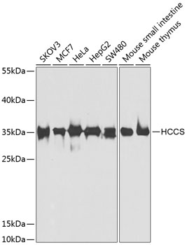 HCCS Polyclonal Antibody (E-AB-61743)