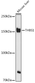 THBS1 Polyclonal Antibody (E-AB-93275)