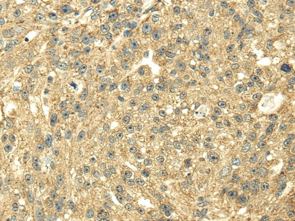SDHA Polyclonal Antibody (E-AB-17014)