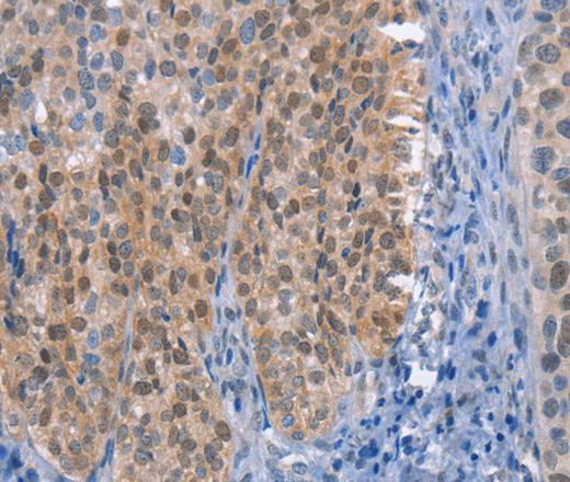 UCK1 Polyclonal Antibody (E-AB-10925)