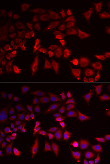 PYGL Polyclonal Antibody (E-AB-61316)