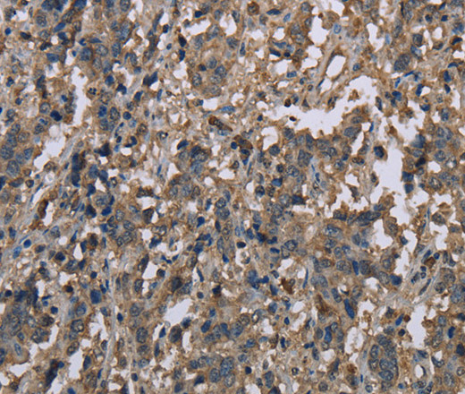 MCC Polyclonal Antibody (E-AB-13404)
