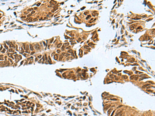PDCD5 Polyclonal Antibody (E-AB-18247)