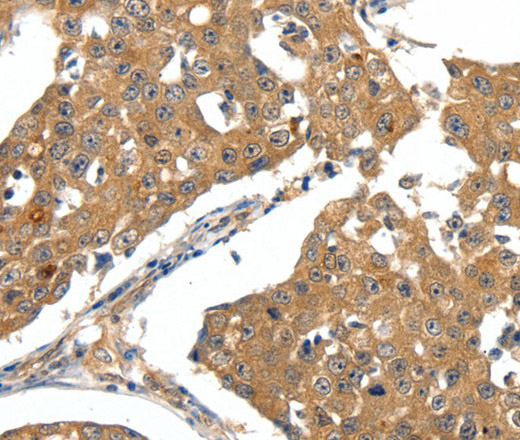 SCN5A Polyclonal Antibody (E-AB-12860)
