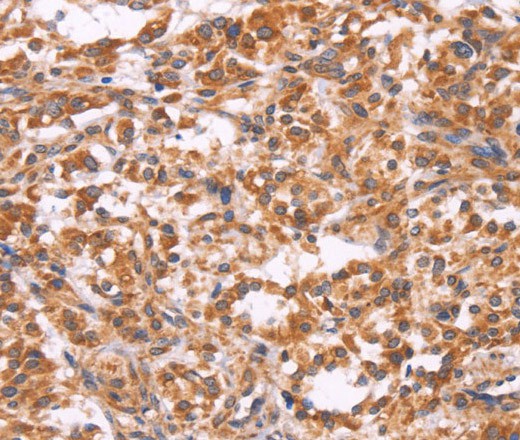 EMP2 Polyclonal Antibody (E-AB-16404)