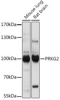 PRKG2 Polyclonal Antibody (E-AB-92095)