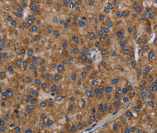 NECTIN2 Polyclonal Antibody (E-AB-15249)