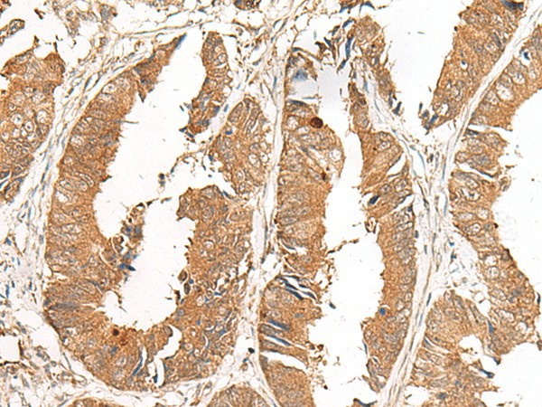 GCC2 Polyclonal Antibody (E-AB-19903)