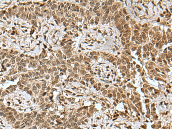 BCL7B Polyclonal Antibody (E-AB-19164)