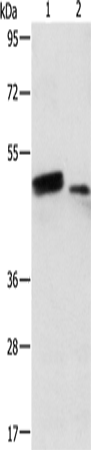 RARB Polyclonal Antibody (E-AB-10006)