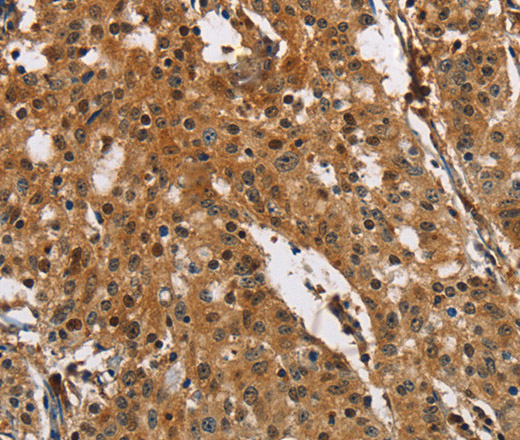 PTK6 Polyclonal Antibody (E-AB-11011)