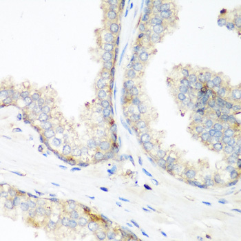 NEDD4 Polyclonal Antibody (E-AB-62147)