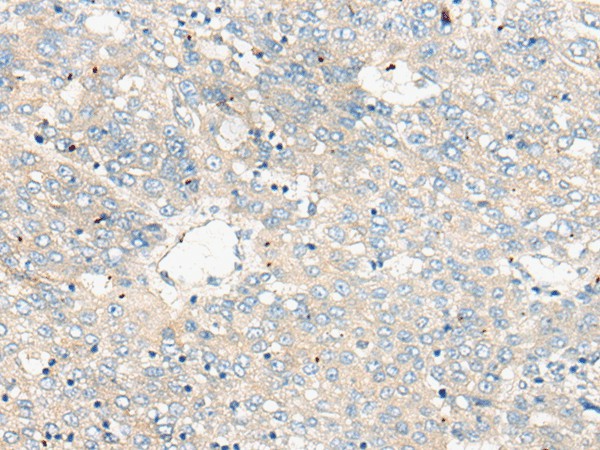 ZNF449 Polyclonal Antibody (E-AB-18468)