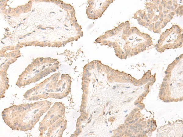 DCD Polyclonal Antibody (E-AB-52582)