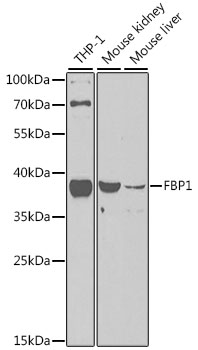FBP1 Polyclonal Antibody (E-AB-60949)