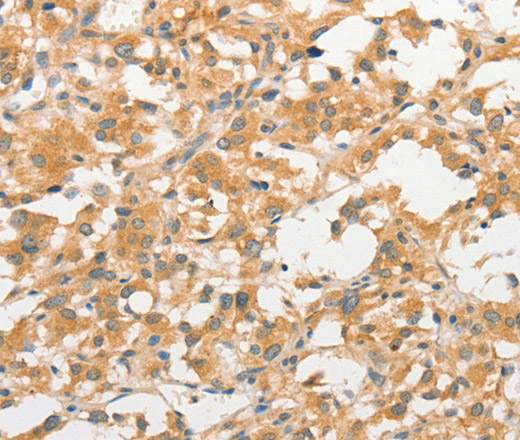 TLR3 Polyclonal Antibody (E-AB-14650)