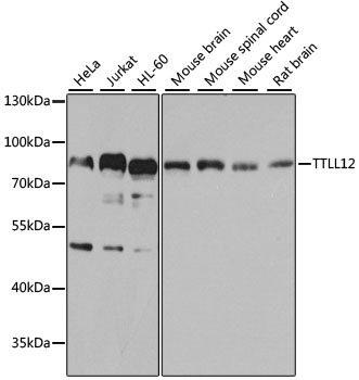TTLL12 Polyclonal Antibody (E-AB-92358)
