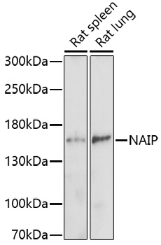 NAIP Polyclonal Antibody (E-AB-66987)