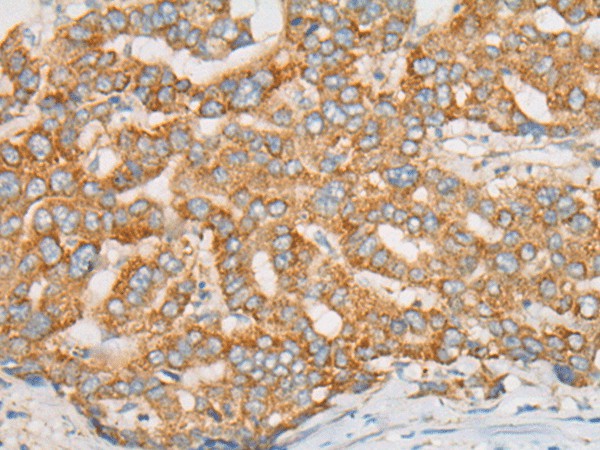 ATXN7 Polyclonal Antibody (E-AB-53584)