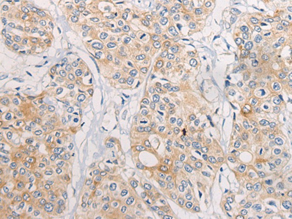CPD Polyclonal Antibody (E-AB-19662)