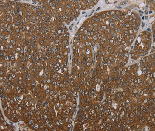 FOLH1B Polyclonal Antibody (E-AB-16440)